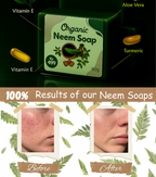 Organic Neem Soap for Acne - 100% Chemical-Free & Natural Formula for Clear Skin Organic soap hub