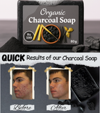 Homemade Organic Charcoal Soap - For Oily Skin & Blackhead Removal.